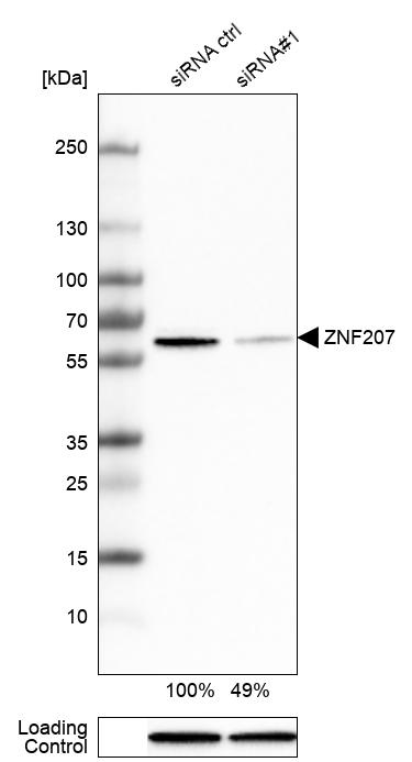 <b>Genetic Strategies Validation. </b>Analysis in HEK293 cells transfected with control siRNA, target specific siRNA probe #1, using Anti-ZNF207 antibody. Remaining relative intensity is presented. Loading control: Anti-GAPDH.