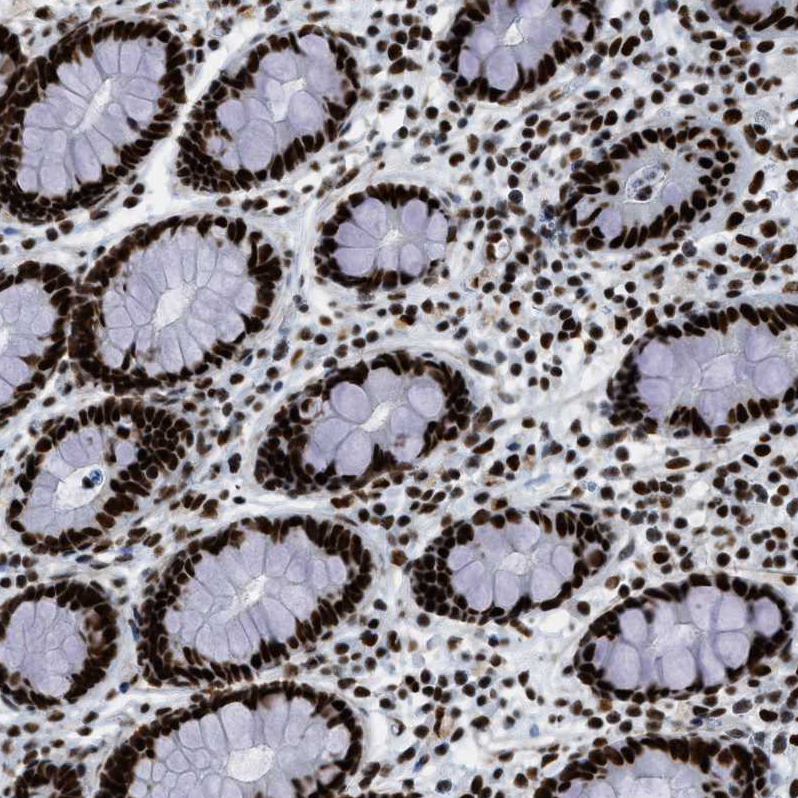 Staining of human colon shows strong nuclear positivity in glandular cells.