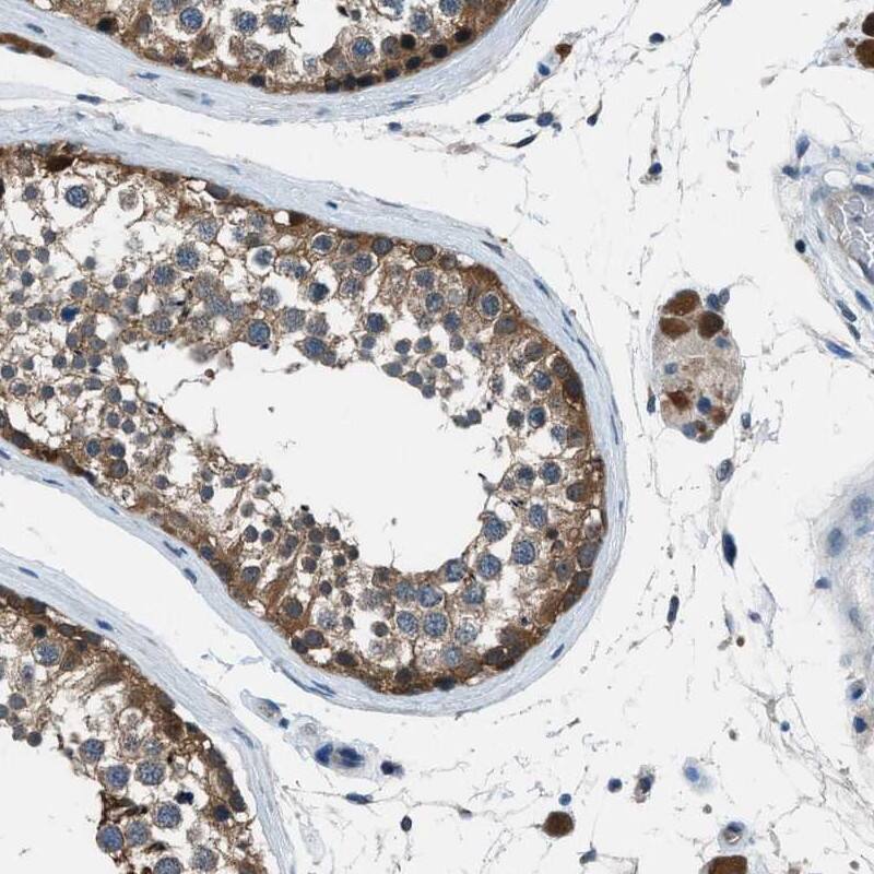 Staining of human testis shows cytoplasmic positivity of cells in seminiferus ducts.