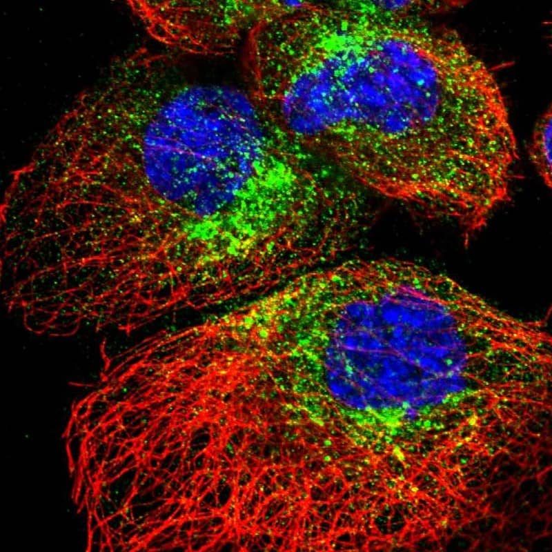 Staining of human cell line A-431 shows localization to the Golgi apparatus & vesicles.