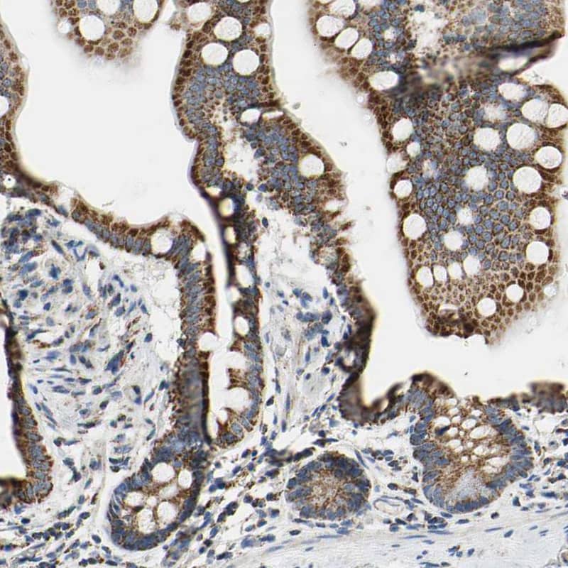 Immunohistochemistry-Paraffin CLPP Antibody - BSA Free