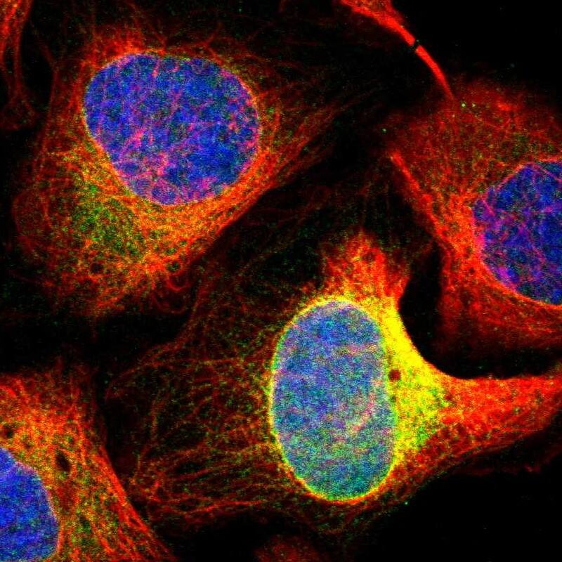 Staining of human cell line U-2 OS shows localization to endoplasmic reticulum.