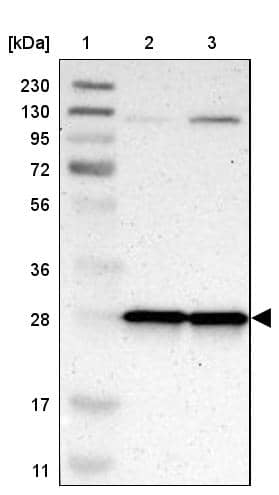 Lane 1: Marker [kDa] 230, 130, 95, 72, 56, 36, 28, 17, 11Lane 2: Human cell line RT-4Lane 3: Human cell line U-251MG sp