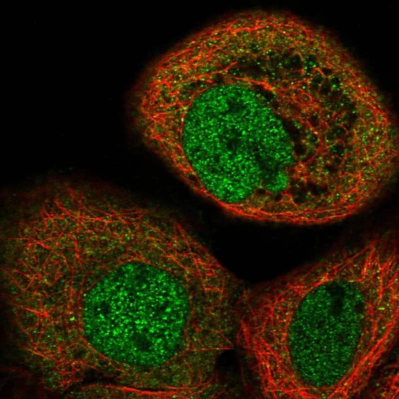 Staining of human cell line A-431 shows localization to nucleoplasm & cytosol.