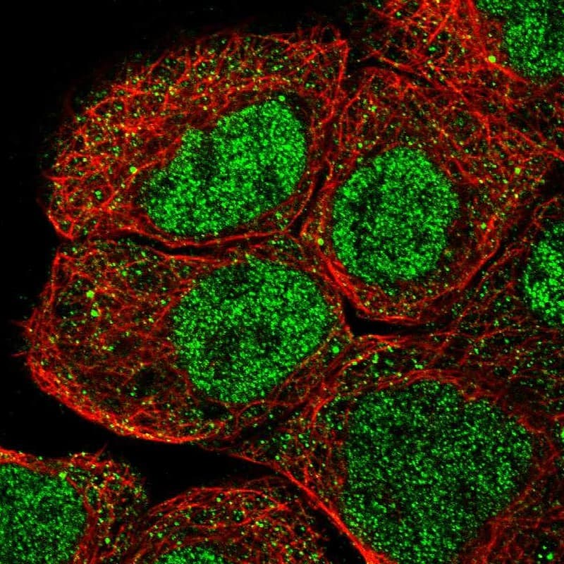 Staining of human cell line A-431 shows localization to nucleoplasm & cytosol.