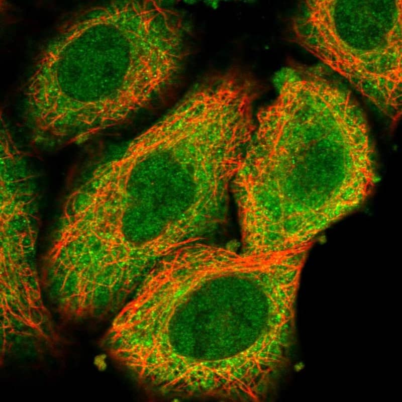 Staining of human cell line A549 shows localization to nucleoplasm & cytosol.