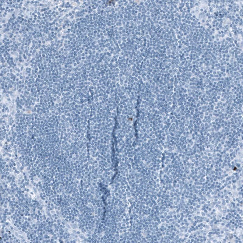 Staining of human lymph node shows no positivity in lymphoid cells as expected.