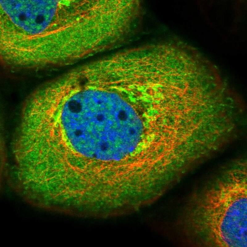Staining of human cell line A-431 shows localization to plasma membrane, cytosol & the Golgi apparatus.
