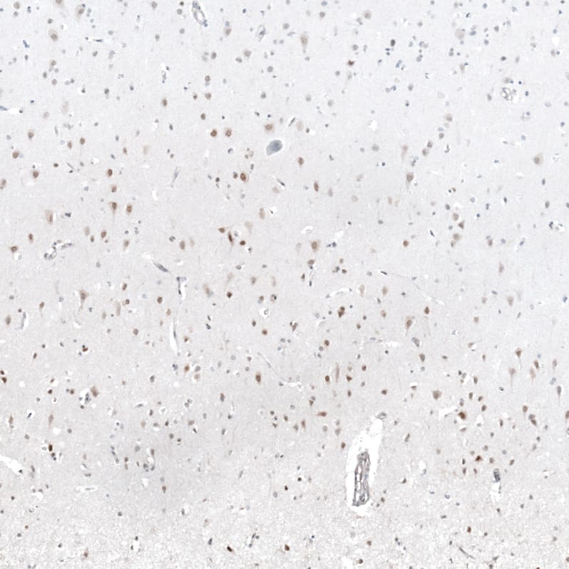 Staining of human cerebral cortex shows moderate nuclear positivity in neuronal cells.