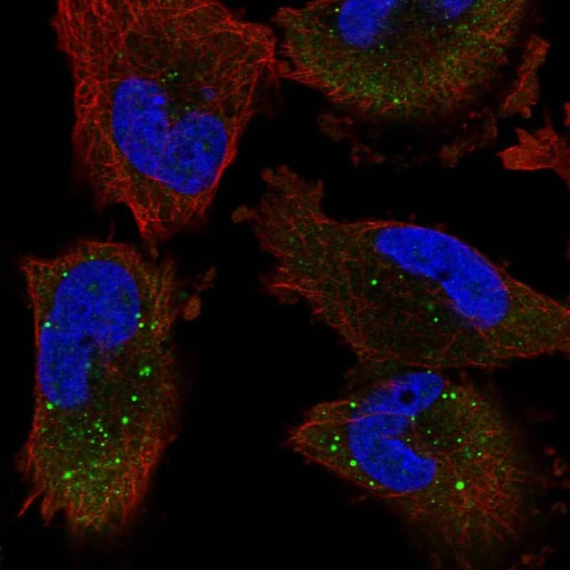 Staining of human cell line U-251 MG shows localization to cytosol & cytoplasmic bodies.
