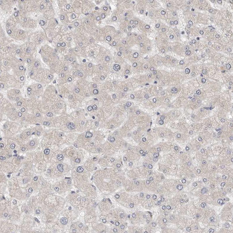 Immunohistochemistry-Paraffin UNK Antibody - BSA Free