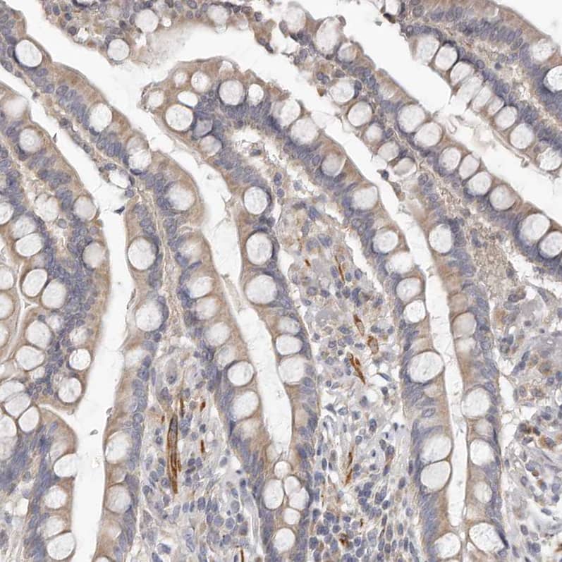 Immunohistochemistry-Paraffin UNK Antibody - BSA Free