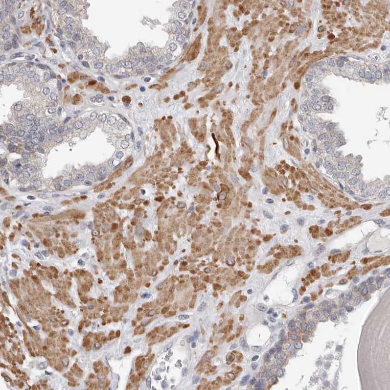 Immunohistochemistry-Paraffin UNK Antibody - BSA Free