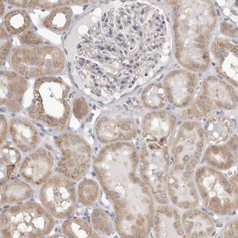 Immunohistochemistry-Paraffin UNK Antibody - BSA Free