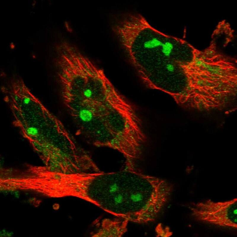 Staining of human cell line U-251 MG shows localization to nucleoli.