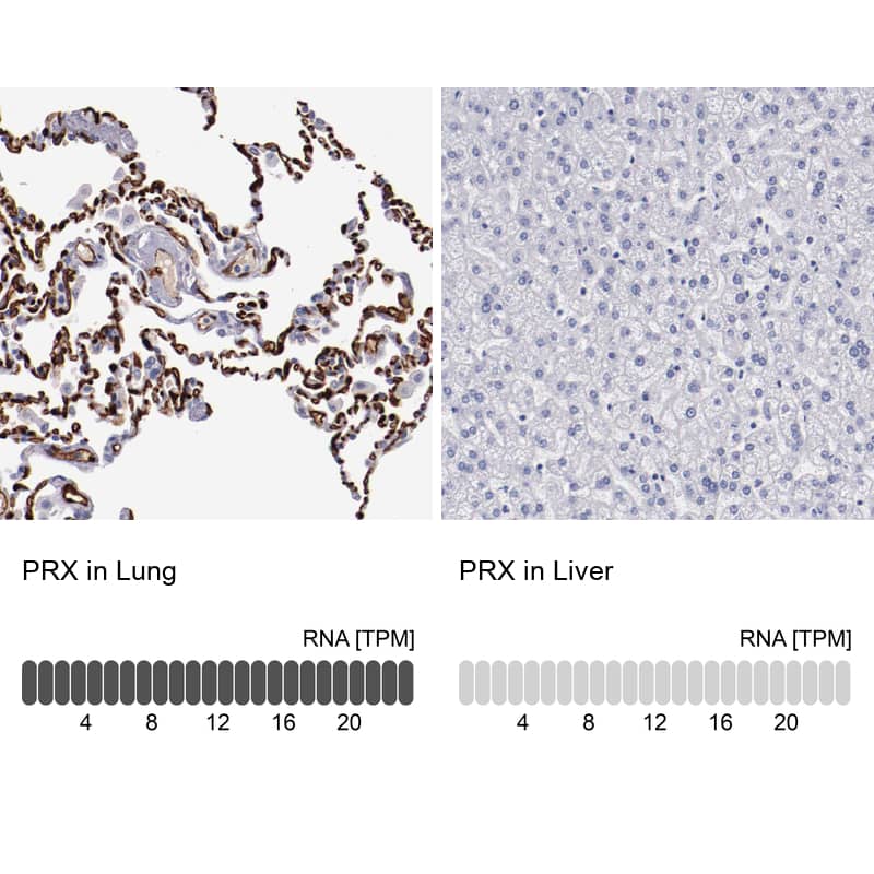 Immunohistochemistry-Paraffin Periaxin Antibody - BSA Free