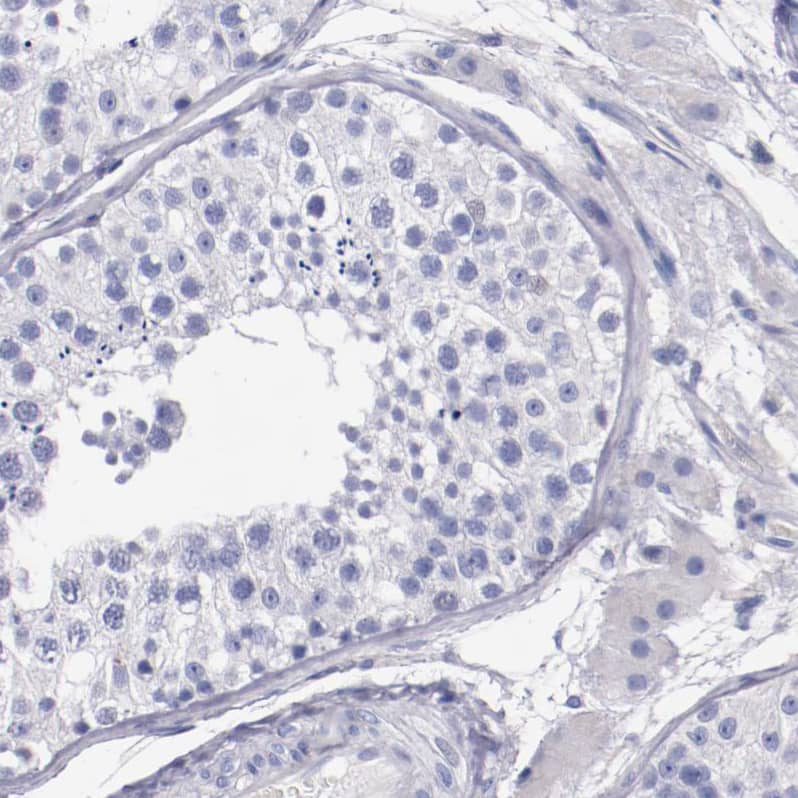 Immunohistochemistry-Paraffin Periaxin Antibody - BSA Free