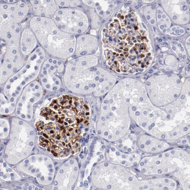 Staining of human kidney shows strong membranous positivity in cells in glomeruli.