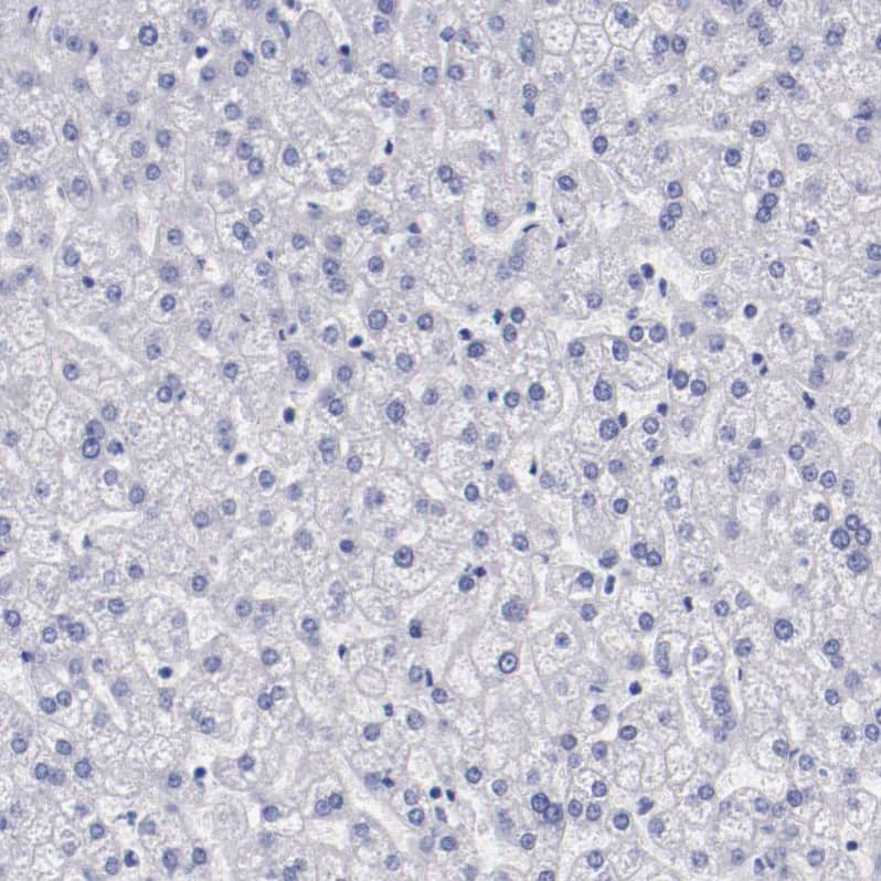Staining of human liver shows no positivity in hepatocytes as expected.