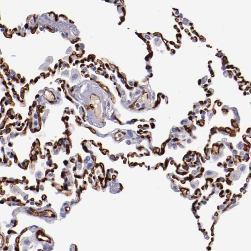 Staining of human lung shows strong membranous positivity in pneumocytes.
