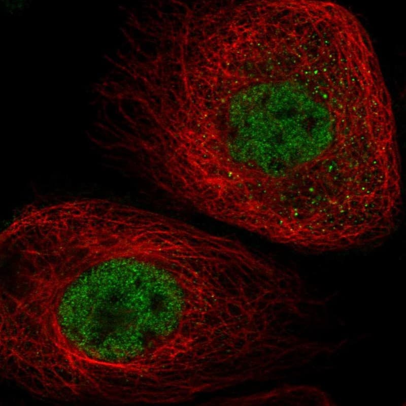 Immunocytochemistry/ Immunofluorescence ATAD2B Antibody - BSA Free