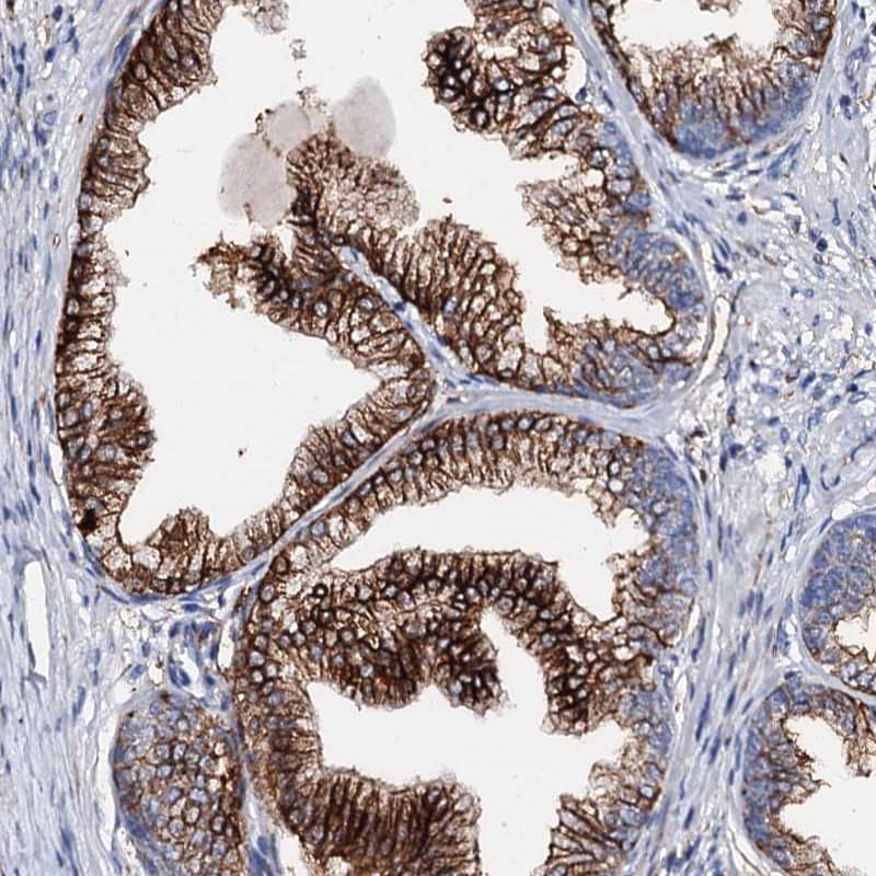 Staining of human prostate shows strong cytoplasmic and membranous positivity in glandular cells.