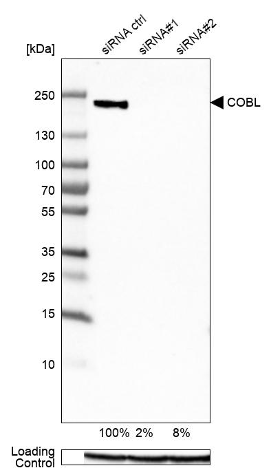 <b>Genetic Strategies Validation. </b>Analysis in HeLa cells transfected with control siRNA, target specific siRNA probe #1 and #2, using Anti-COBL antibody. Remaining relative intensity is presented. Loading control: Anti-GAPDH.