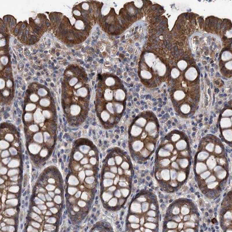 Staining of human colon shows strong cytoplasmic positivity in glandular cells.
