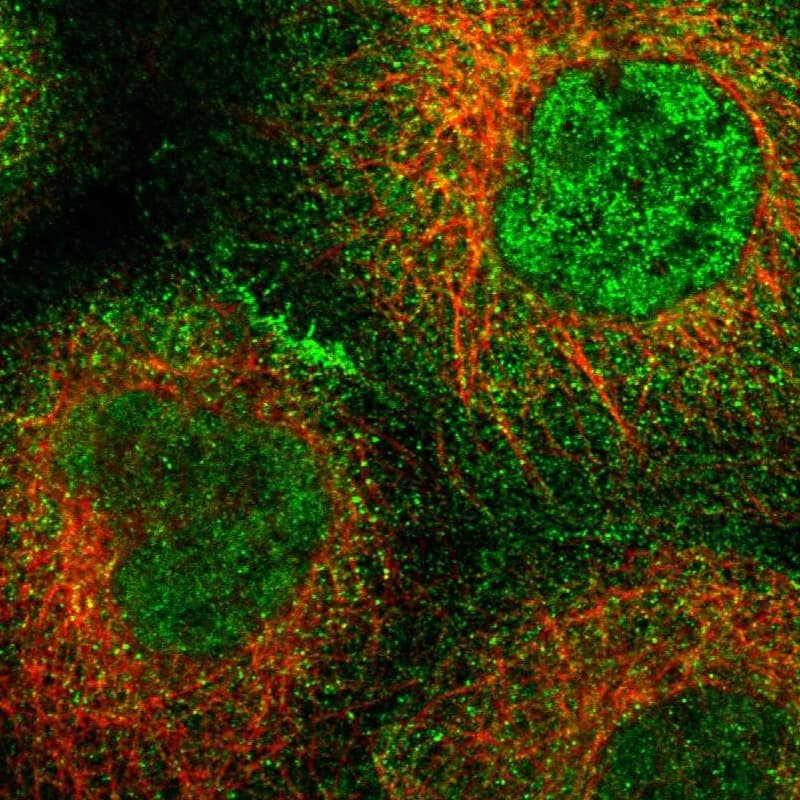 Staining of human cell line A-431 shows localization to nucleoplasm, plasma membrane & cytosol.