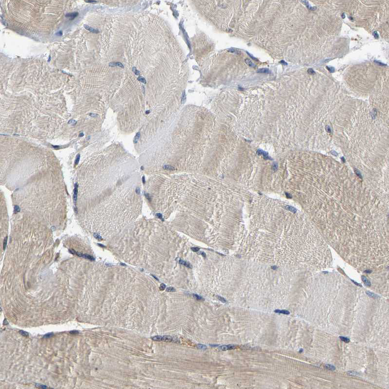 Staining of human skeletal muscle shows moderate cytoplasmic positivity in myocytes.