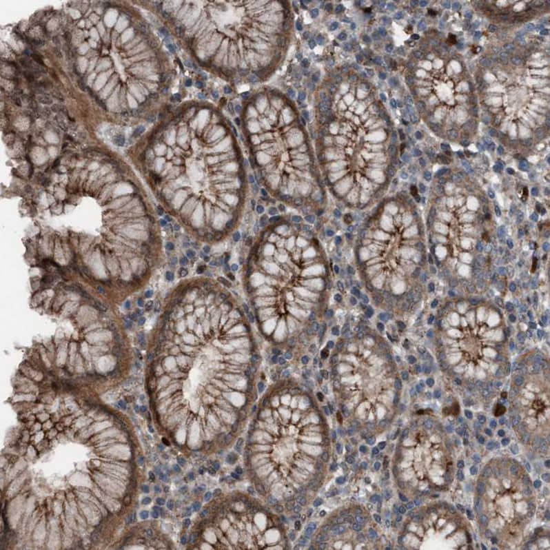 Staining of human stomach shows strong cytoplasmic positivity in glandular cells.