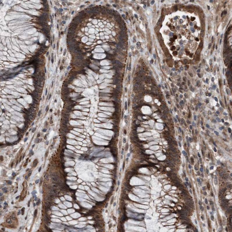 Staining of human rectum shows strong cytoplasmic positivity in glandular cells.
