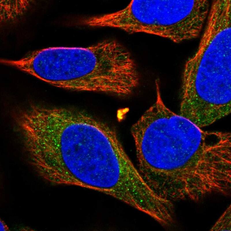 Staining of human cell line U-2 OS shows localization to cytosol.