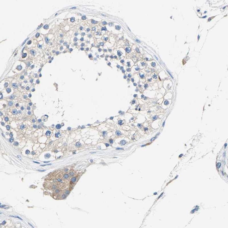 Staining of human testis shows moderate cytoplasmic positivity in Leydig cells.
