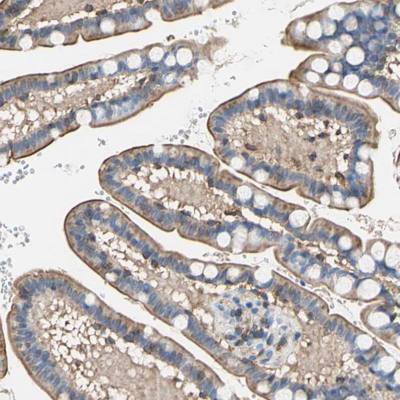 Staining of human small intestine shows strong cytoplasmic-membranous positivity in glandular cells.