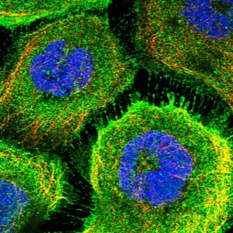 Staining of human cell line A-431 shows localization to plasma membrane.