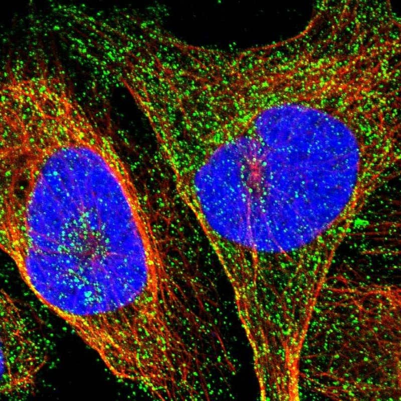 Staining of human cell line U-2 OS shows localization to vesicles.