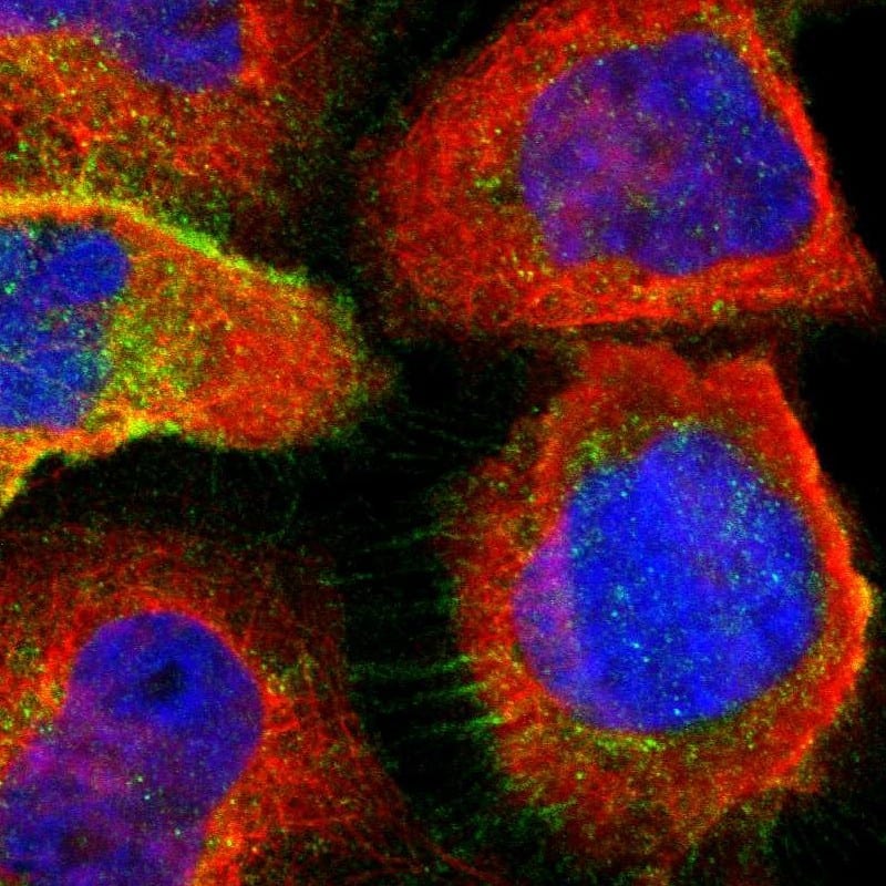 Staining of human cell line A-431 shows localization to nucleoplasm, plasma membrane & cytosol.