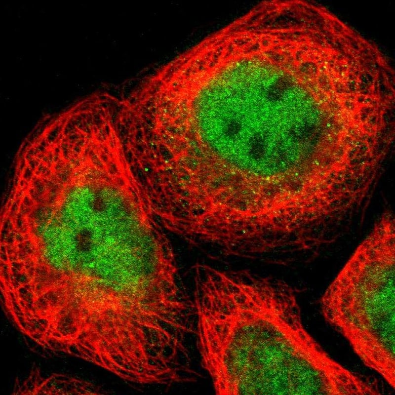 Staining of human cell line A-431 shows localization to nucleoplasm & cytosol.