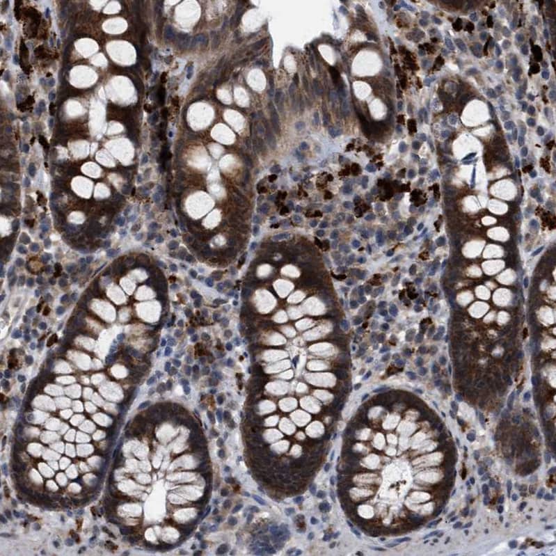 Staining of human colon shows strong cytoplasmic positivity in glandular cells.