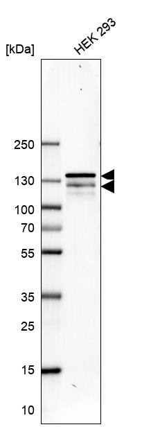 <b>Genetic Strategies Validation. </b>Analysis in A-549 cells transfected with control siRNA, target specific siRNA probe #1 and #2, using Anti-UPF1 antibody. Remaining relative intensity is presented. Loading control: Anti-GAPDH.