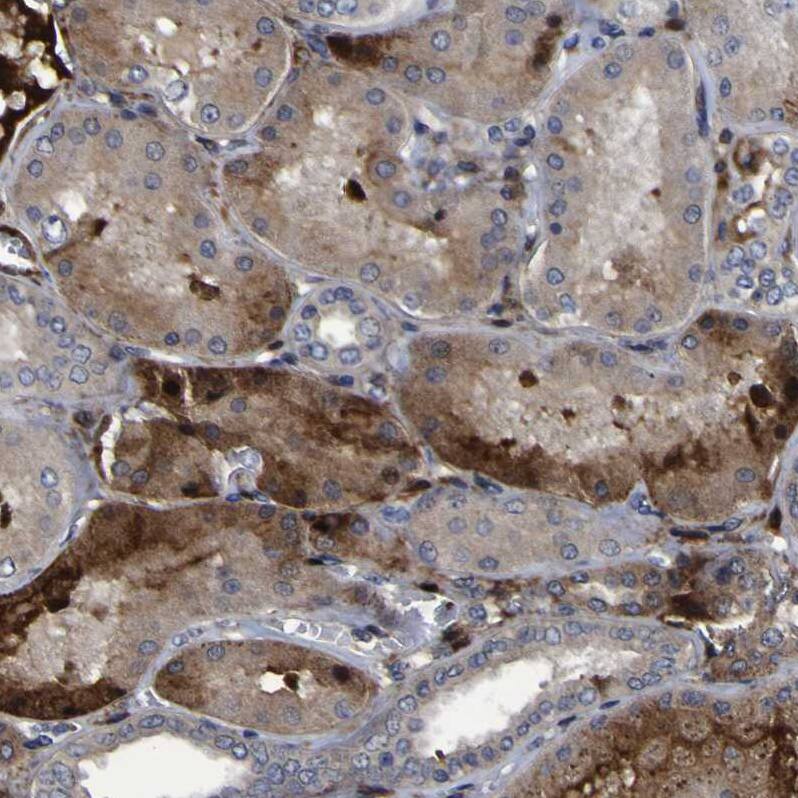 Staining of human kidney shows moderate cytoplasmic positivity in cells in tubules.