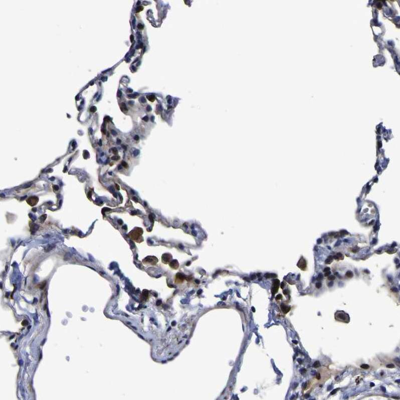 Staining of human lung shows moderate cytoplasmic positivity in macrophages.