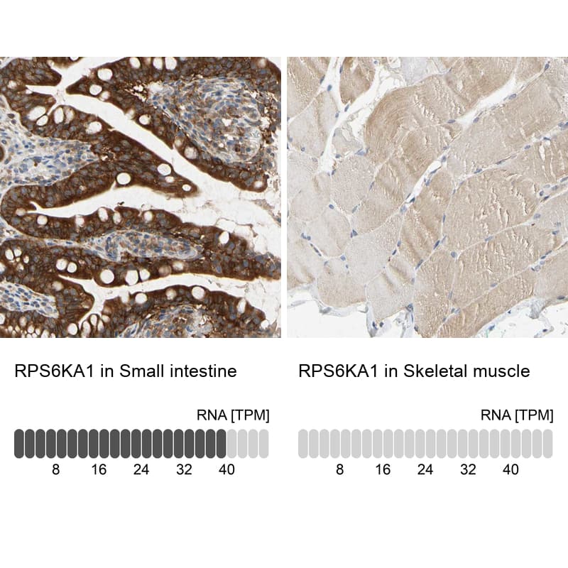 <b>Orthogonal Strategies Validation. </b>Analysis in human small intestine and skeletal muscle tissues.