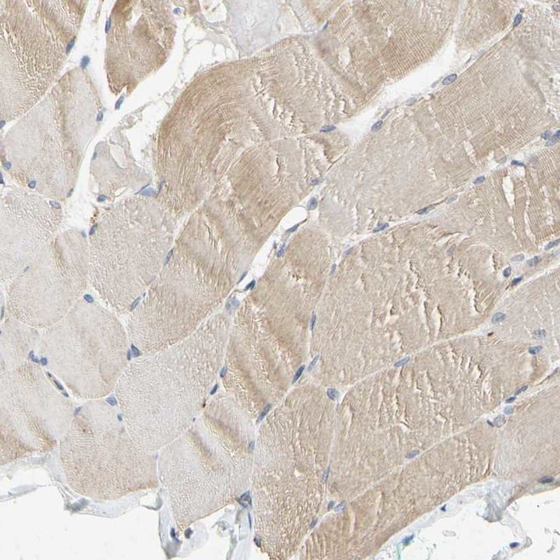 Staining of human skeletal muscle shows low expression as expected.