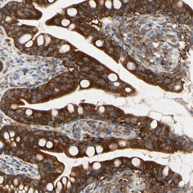 Staining of human small intestine shows high expression.