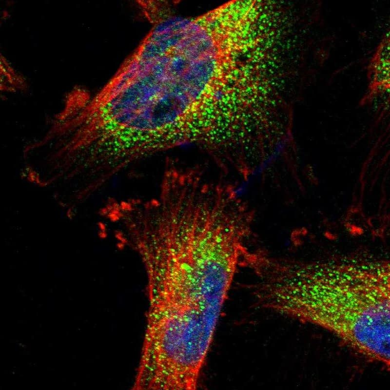 Staining of human cell line U-251 MG shows localization to vesicles.