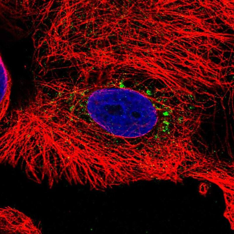 Staining of human cell line CACO-2 shows localization to the Golgi apparatus.