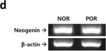 An ELISA of PGD2 in human follicular fluid and the culture medium of RGMc-treated CCs. (a) The PGD2 level in follicular fluid of patients with a POR and young and old patients with a normal ovarian response. (b,c) The ELISA data of PGD2 level in the culture media of RGMc-treated CCs obtained from (b) patients with a normal ovarian response and (c) patients with a POR. (d) Gene expression of neogenin in human CCs of normal and POR patients. All assays were repeated three times with different samples for statistical analysis. * p < 0.05 and *** p < 0.001 versus the young and old normal ovarian response groups. Image collected and cropped by CiteAb from the following open publication (//pubmed.ncbi.nlm.nih.gov/33801938), licensed under a CC-BY license. Not internally tested by Novus Biologicals.