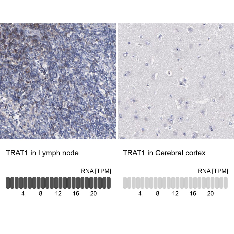 Immunohistochemistry-Paraffin TRIM Antibody - BSA Free
